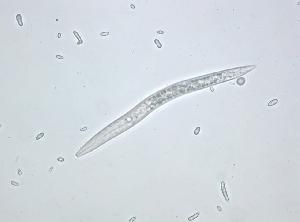 Пшеничная нематода (Anguina tritici)