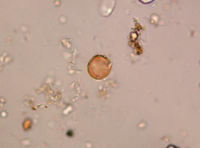 Твердая головня пшеницы (Tilletia caries)