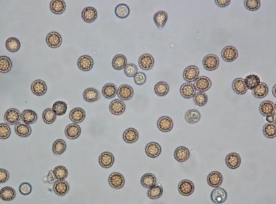 Карликовая головня (Tilletia controversa)